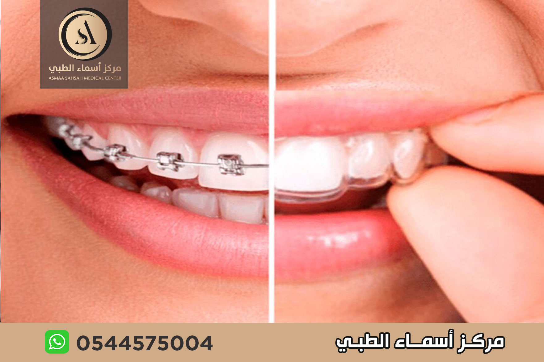  تقويم اسنان في الشارقة