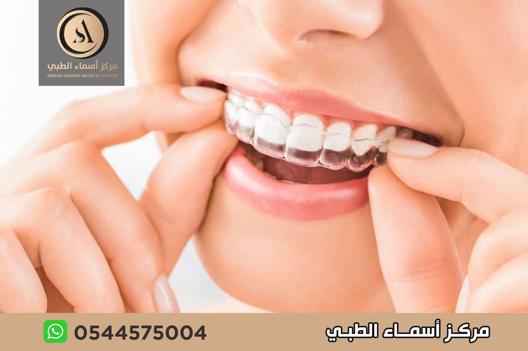 تقويم اسنان في الشارقة