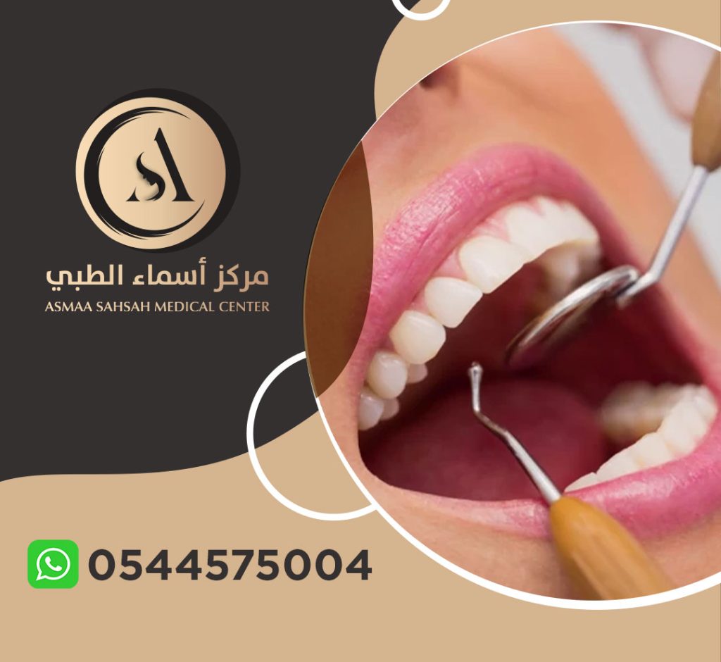مركز تجميل اسنان في الشارقة