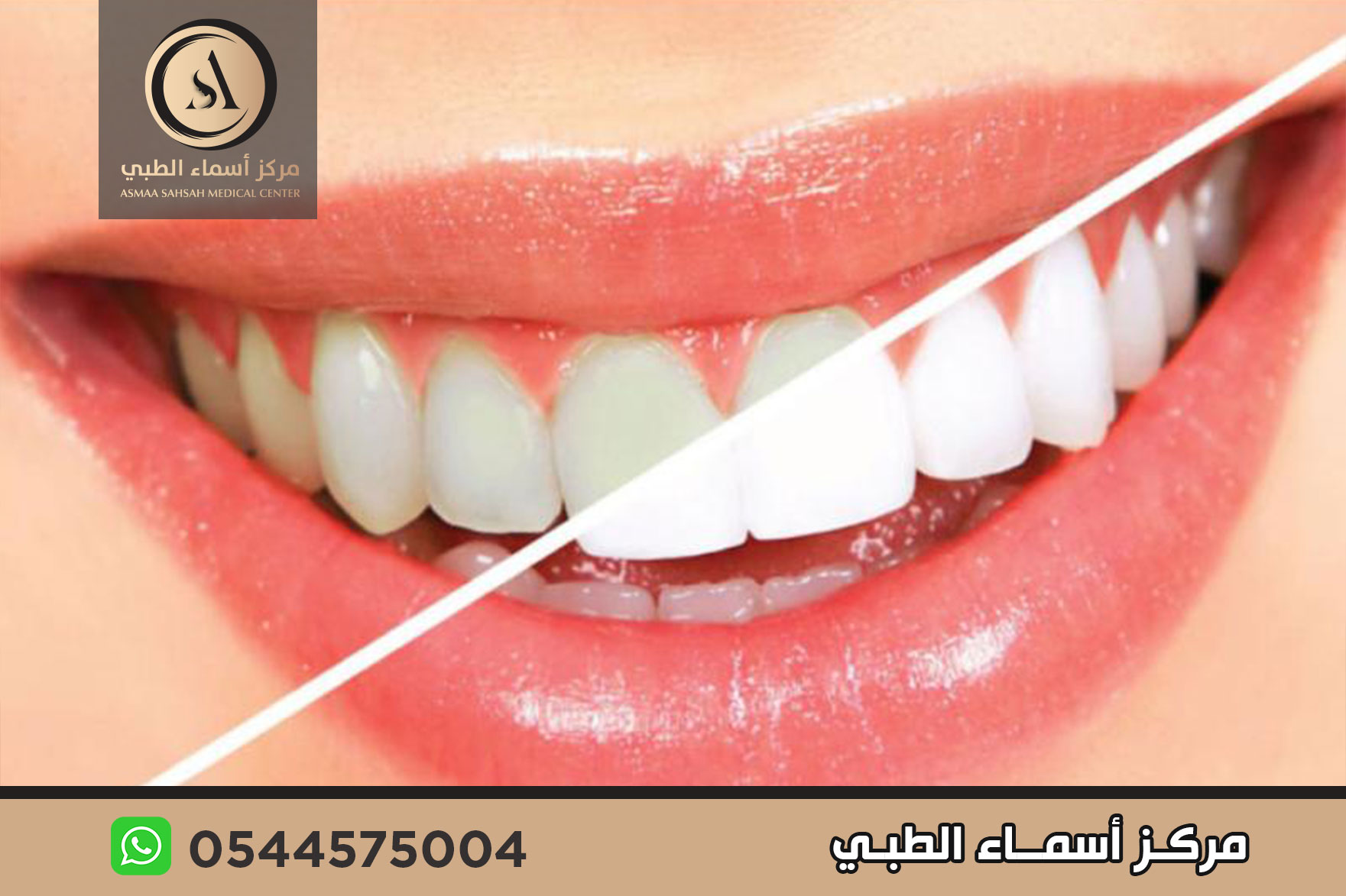 عيادة تجميل اسنان في الشارقة