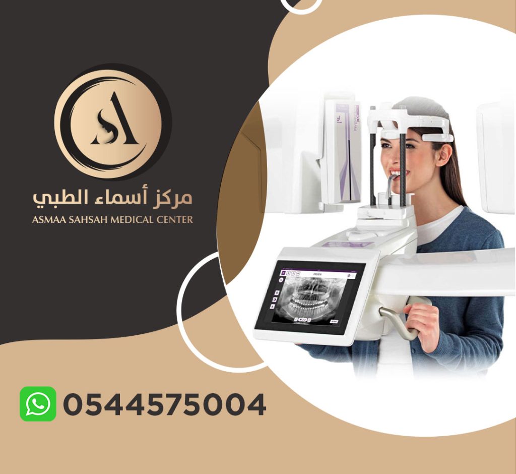 مركز أشعة اسنان في الشارقة