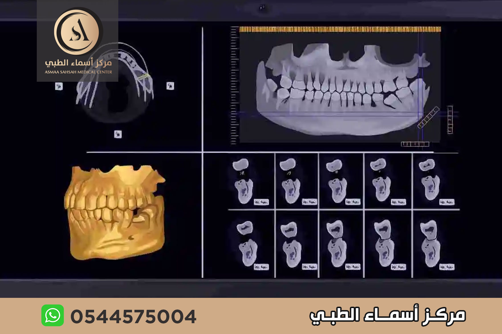 مركز أشعة اسنان في الشارقة