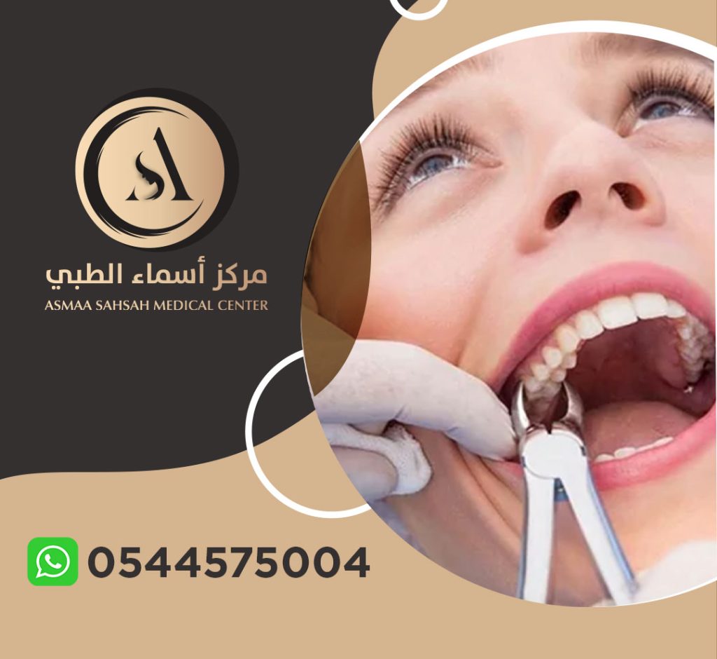 عيادة خلع اسنان في الشارقة