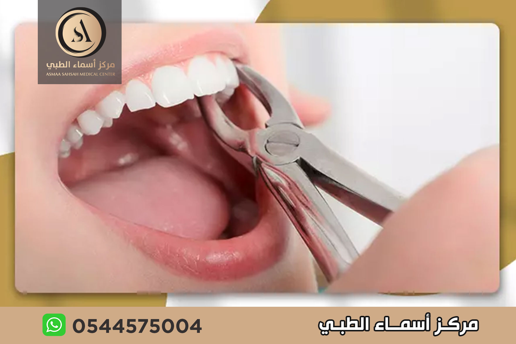 عيادة خلع اسنان في الشارقة