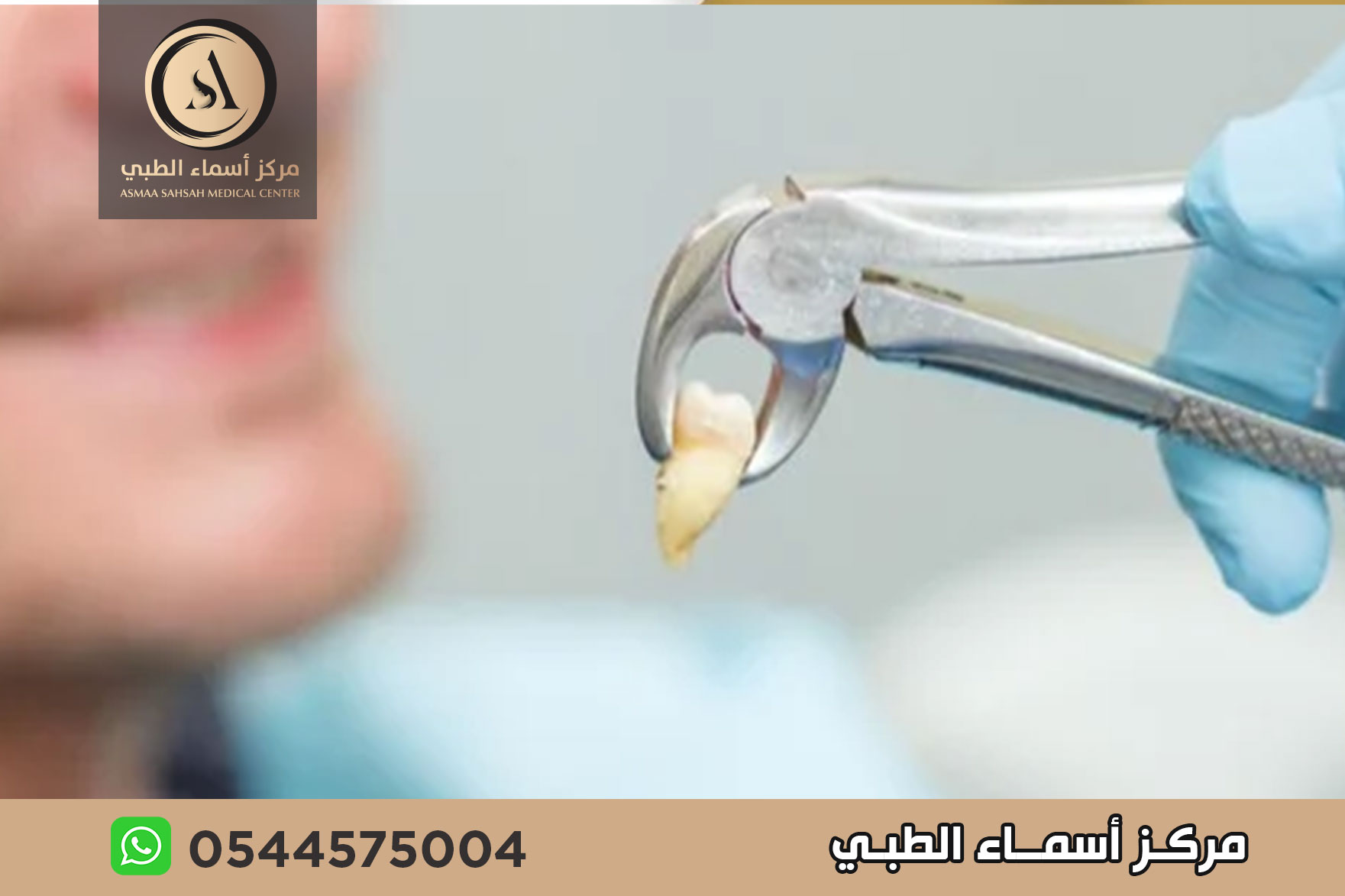 عيادة خلع اسنان في الشارقة