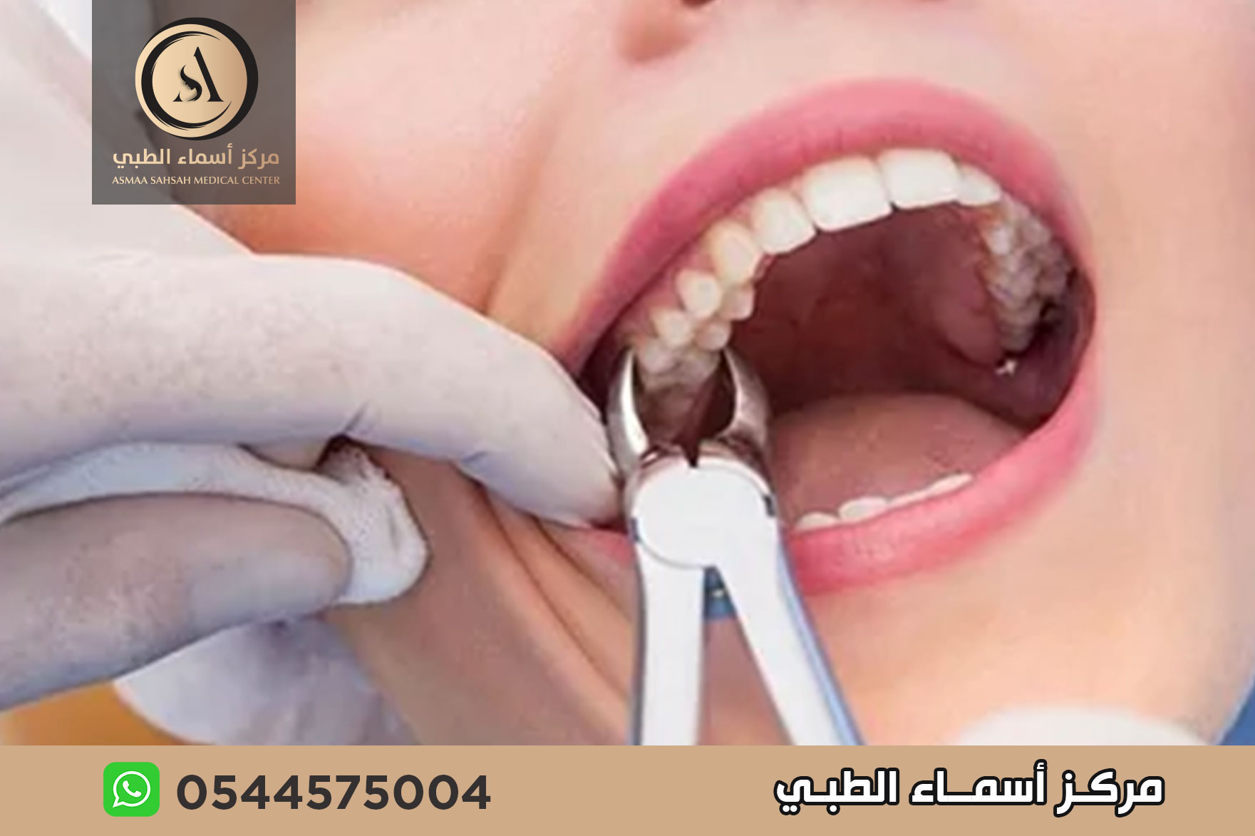خلع اسنان في الشارقة