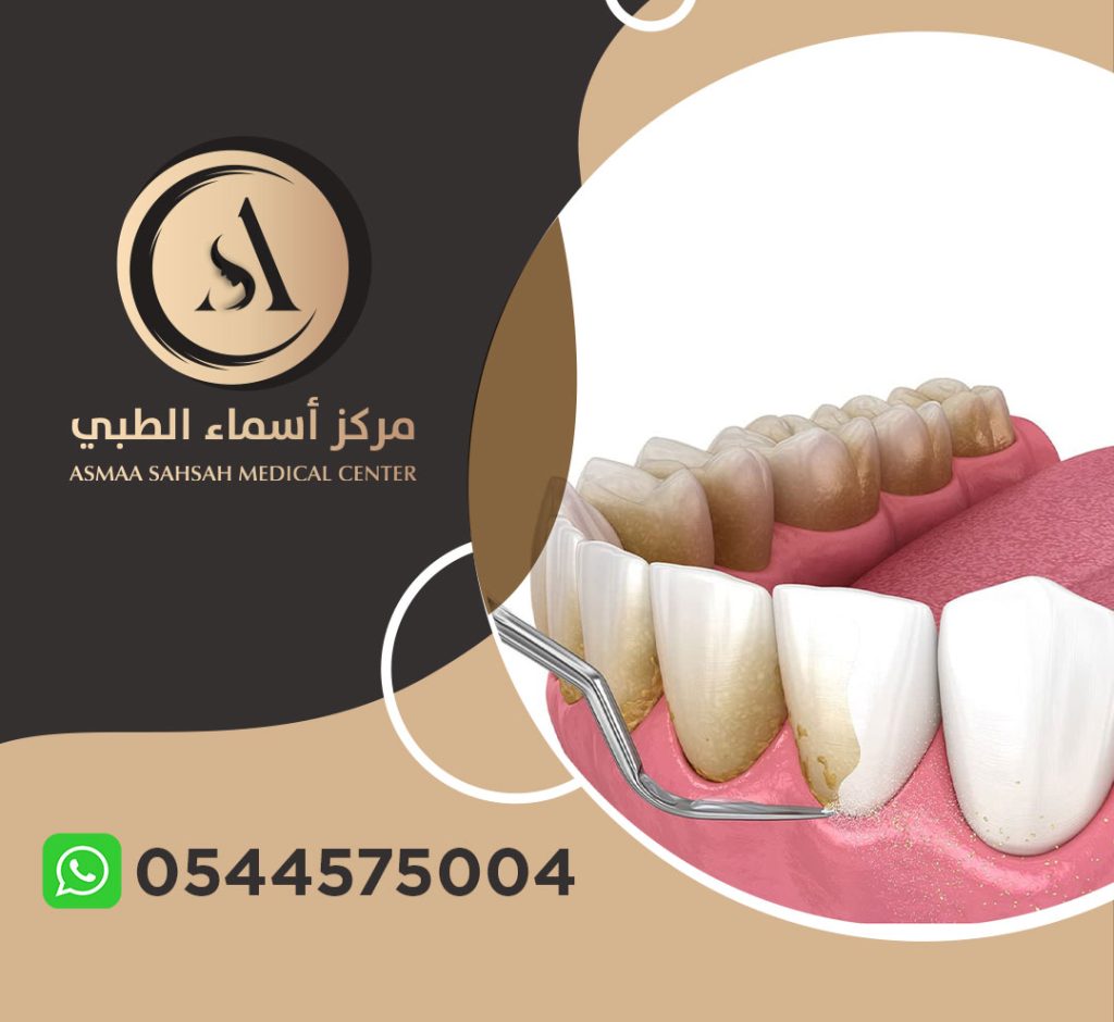 عيادة تنظيف اسنان في الشارقة