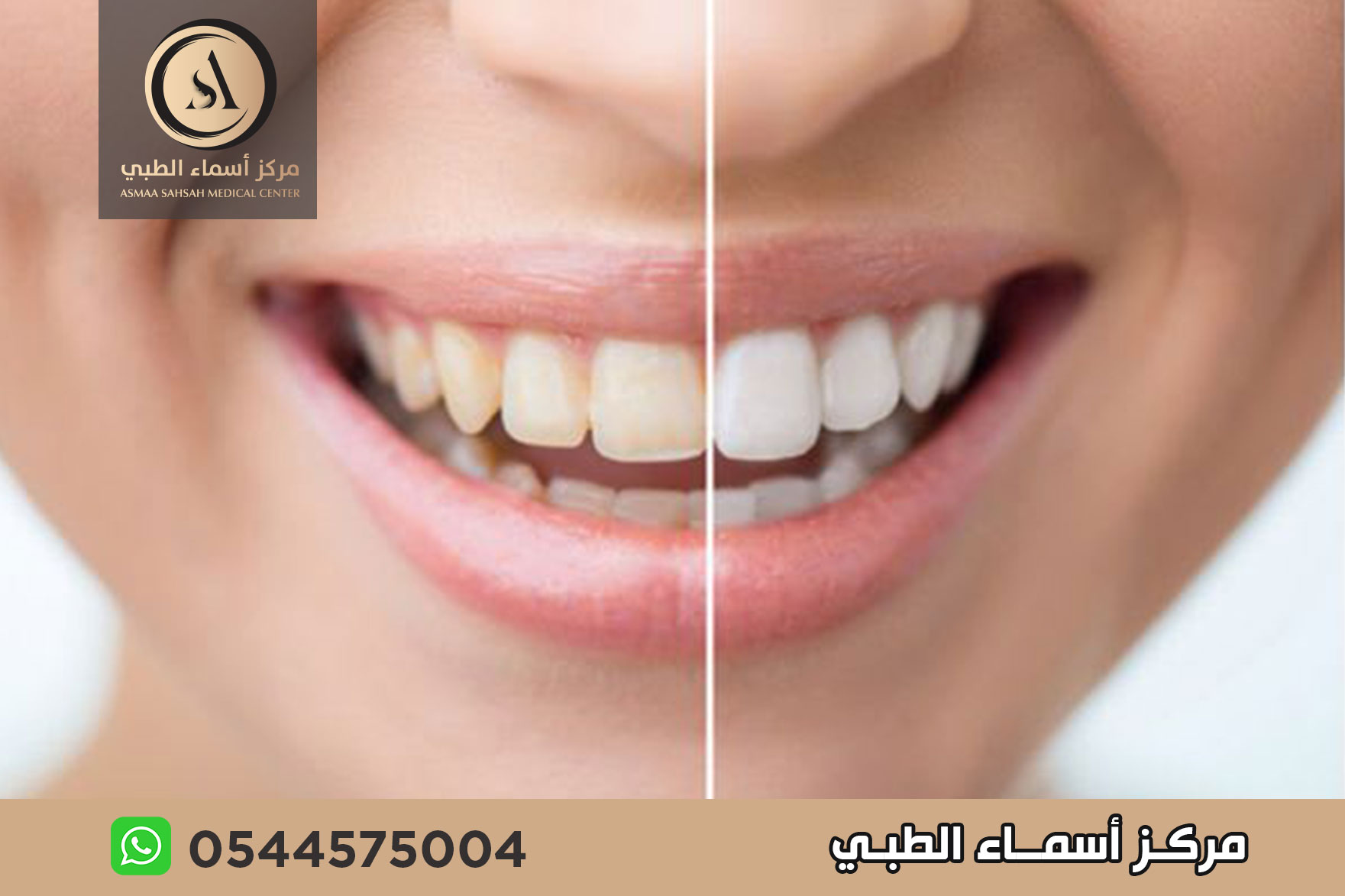 عيادة تجميل اسنان في الشارقة