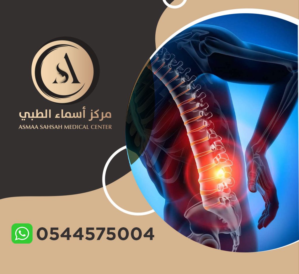علاج ألم عرق النسا في الشارقة