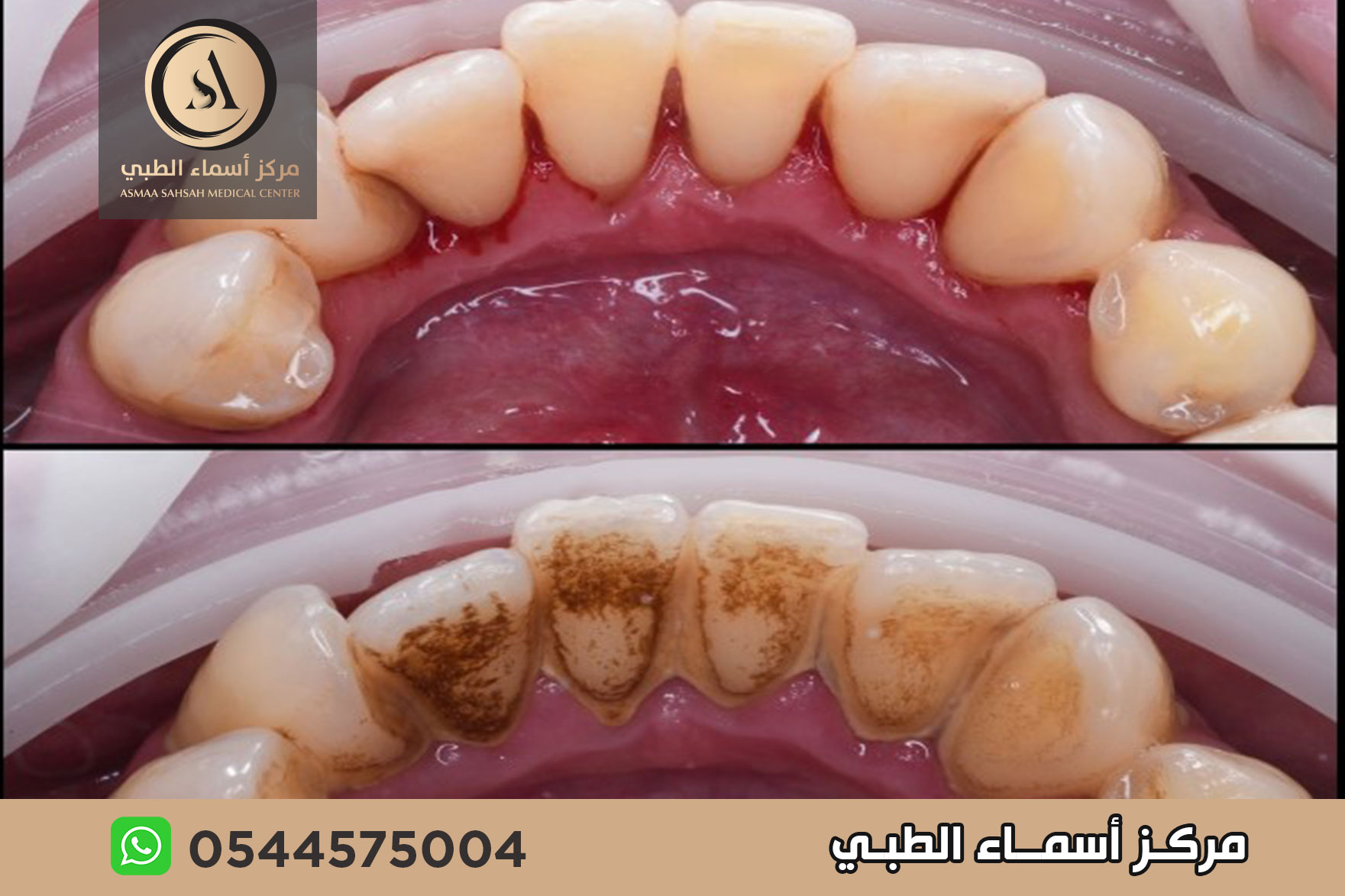 مركز تنظيف اسنان في الشارقة