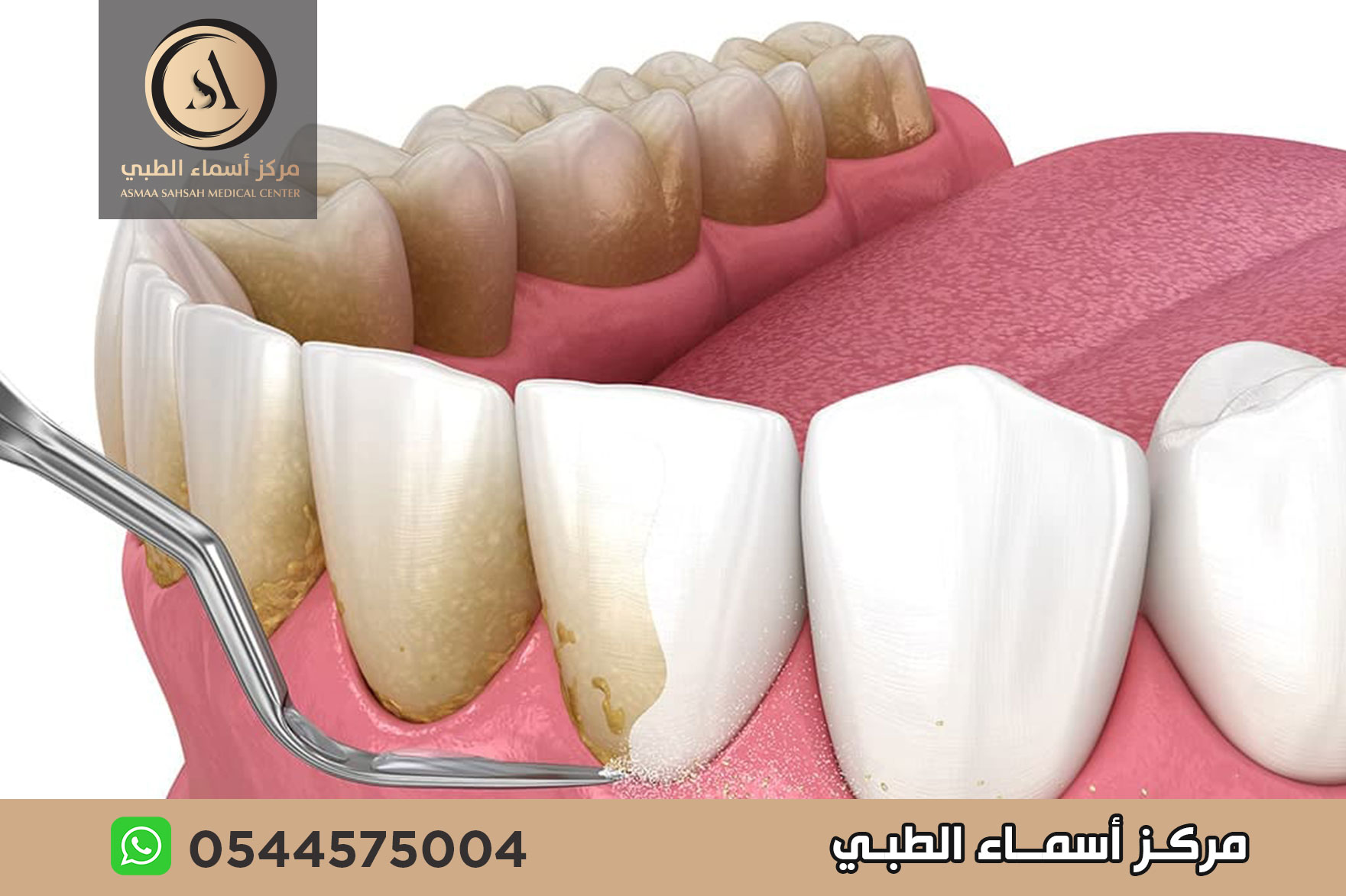 مركز تنظيف اسنان في الشارقة