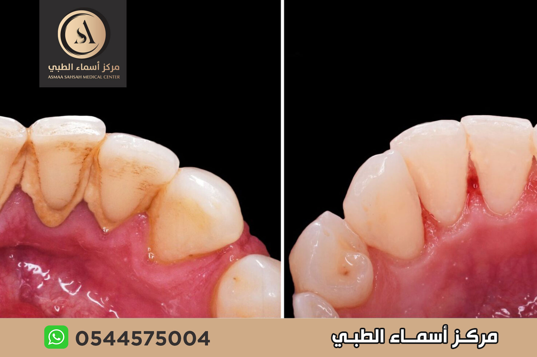 مركز تنظيف اسنان في الشارقة