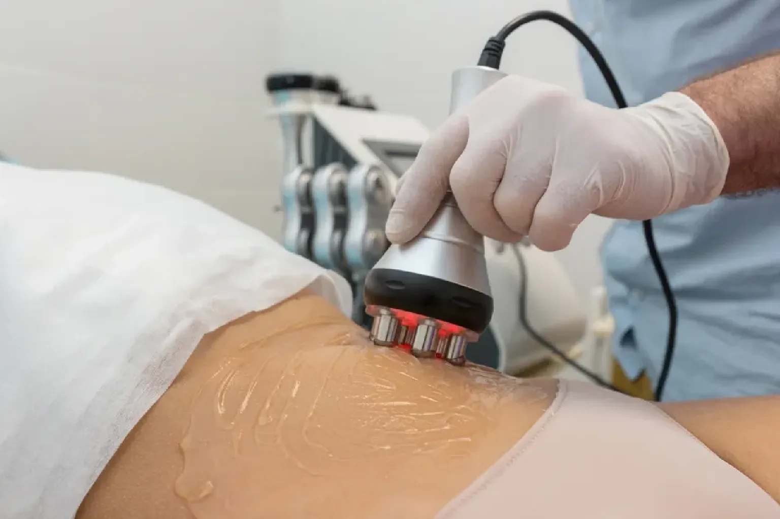Radiofrequency (RF) devices
