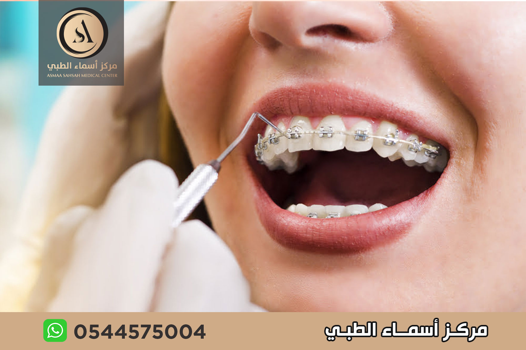 مركز تقويم اسنان في الشارقة
