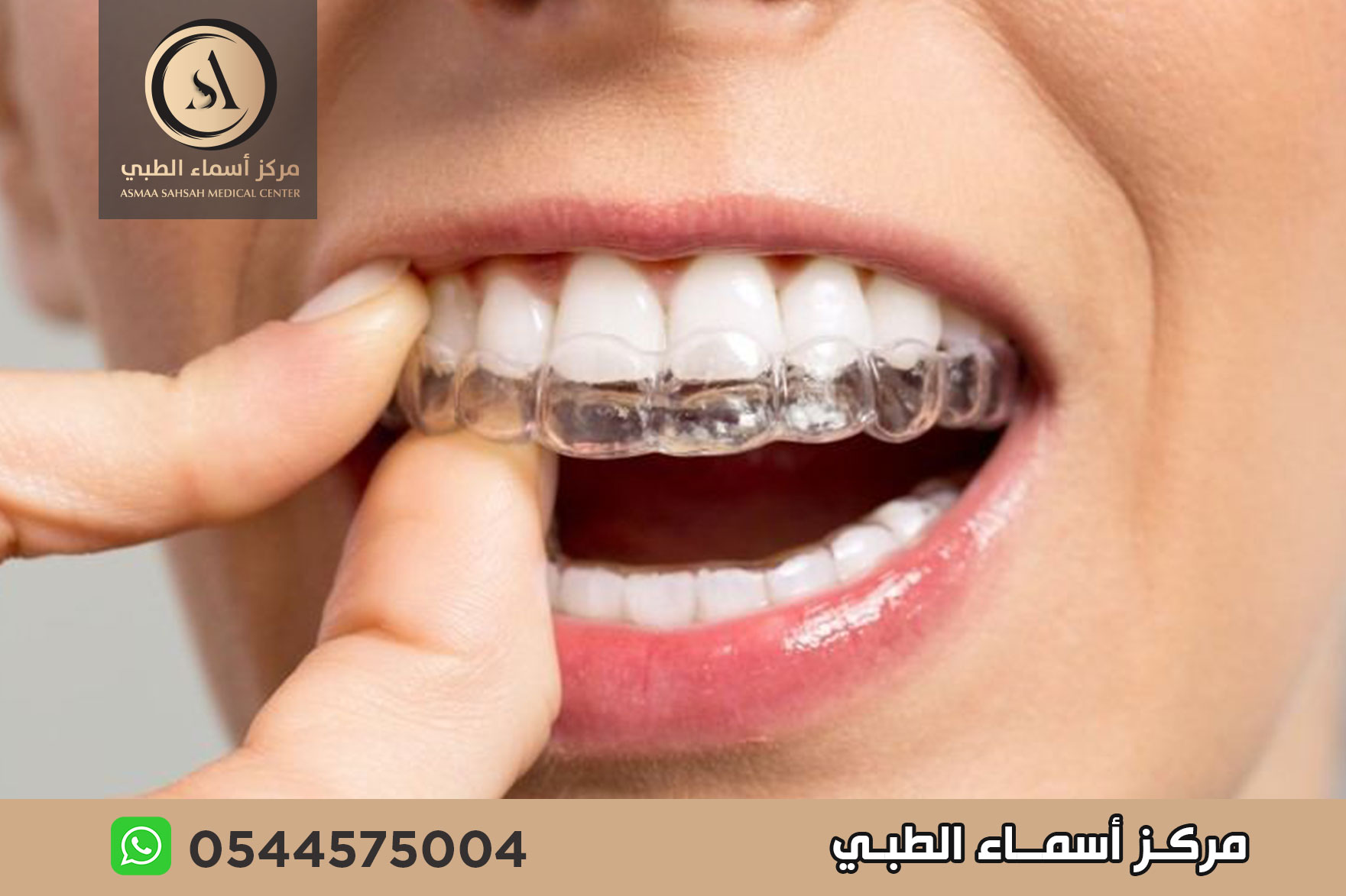 مركز تقويم اسنان في الشارقة