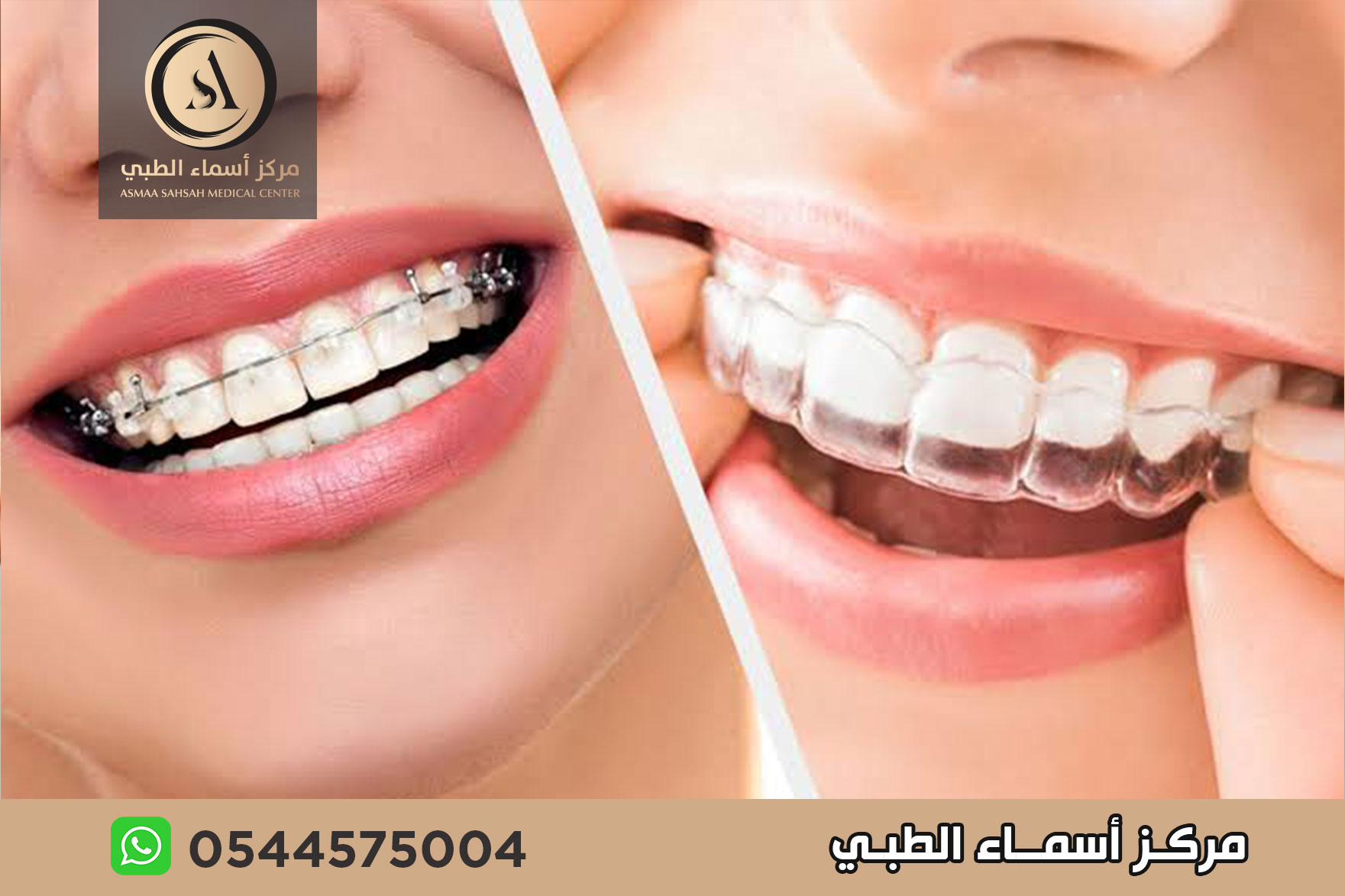 مركز تقويم اسنان في الشارقة