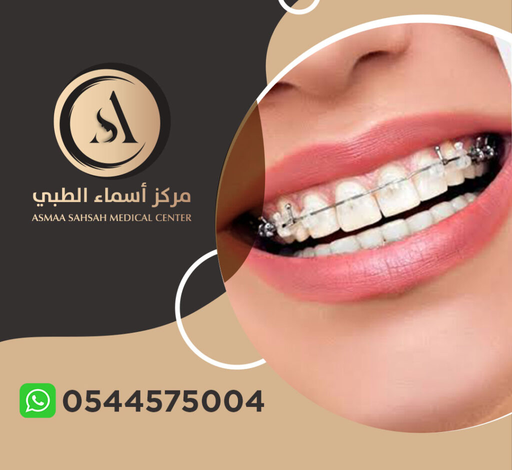 مركز تقويم اسنان في الشارقة