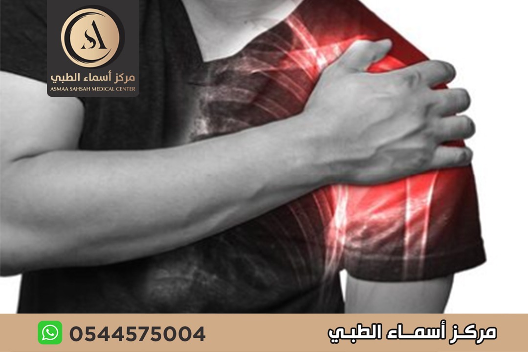 علاج تمزق أربطة الكتف في الشارقة