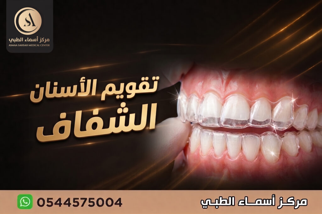 تقويم الاسنان الشفاف في الشارقة